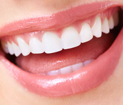 A Complete Guide to the Pros and Cons of Dental Veneers