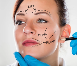 Facelift Surgery: A Surgical Technique to Restore Youth