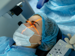 Laser Eye Surgery: Decoding the Mystery Behind Vision Correction